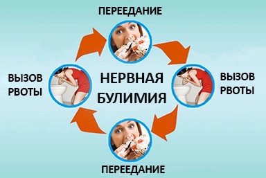 Лечение булимии в Куйбышеве